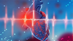 US-Mediziner empfehlen 5 neue Maßnahmen gegen Herzinfarkt