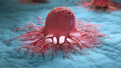 Verheiratete bekommen seltener Krebs – vor allem 2 Arten