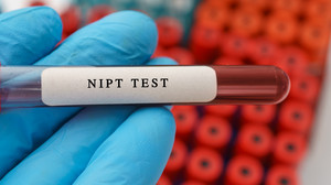 Wie sinnvoll ist der NIPT-Bluttest?