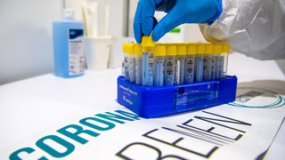 Wie bekommt man kostenlose PCR-Test in Hessen?