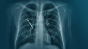 Tausende OP-Behandlungsfehler pro Jahr