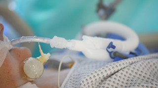 Sauerstoffgerät ausgeschaltet: Was geschah in Mannheimer Klinik?