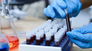 Neuer Bluttest entdeckt Krebs, den übliche Methoden übersehen