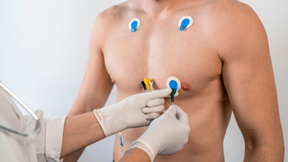 Herztod beim Sport: Wie KI-gestützte Herzvorsorge dies vermeiden hilft