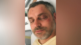 Gewaltattacke auf Matthias N. in Göttingen: Fotosuche 2 Jahre nach Tat