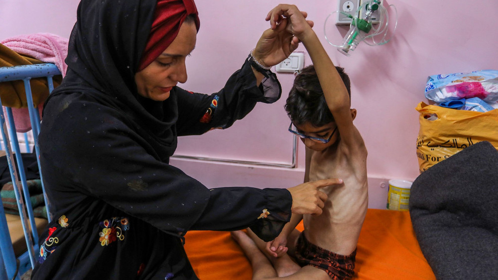 Nahost-Konflikt - Unterernährte palästinensische Kinder