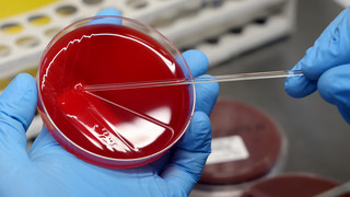 Meningokokken-Fall in Darmstadt-Kita: Was Eltern wissen müssen