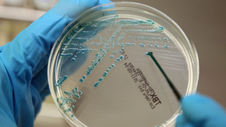 Fuldabrück: Coli-Bakterien in Bauernbratwurst-Ring gefunden