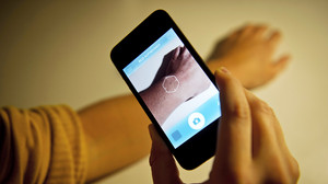 Telemedizin: Handy-App ersetzt Hautarzt-Besuch