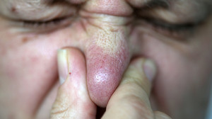 Was stinkt hier so? Anwohner in Offenbach haben Atemprobleme