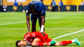 Jamal Musiala schockt Bayern mit Wadenbeinbruch