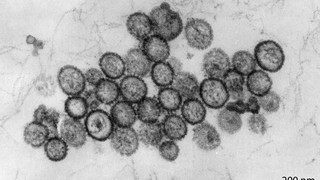 Hantavirus: Drei Tote auf Kreuzfahrtschiff im Atlantik