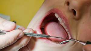 Zahnzusatzversicherung: Lohnt es sich für mich?