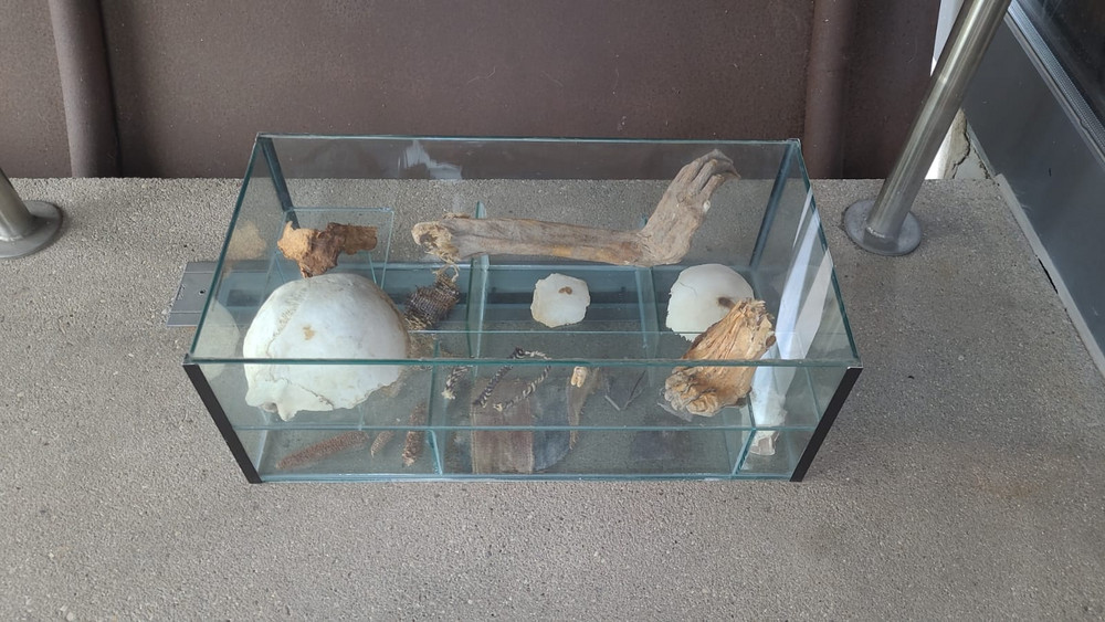 Menschliche Knochen aus Speyer in einem Glaskasten