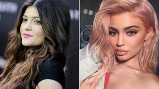 Unterm Messer: Stars mit Schönheits-OPs