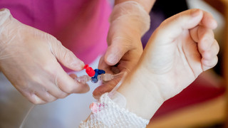 Trend für die Gesundheit: Ärzte sehen Vitamin-Infusionen kritisch