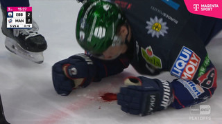 Hart, härter, Müller! Auch Pucktreffer im Gesicht kann Berlins Nationalverteidiger nicht stoppen