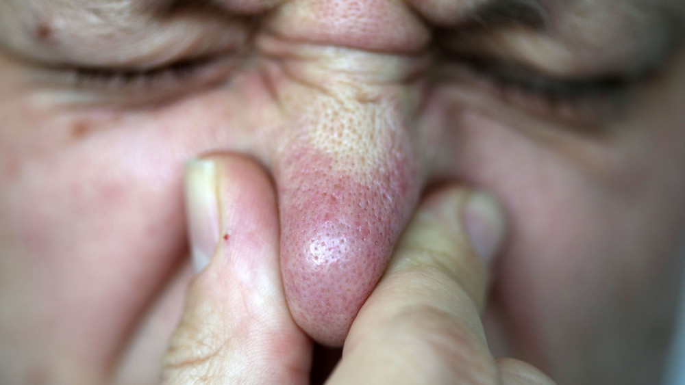 Gestank in Karlstein 