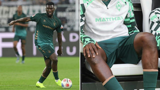 Boniface droht Saison-Aus: Bremen bestätigt Ausfall