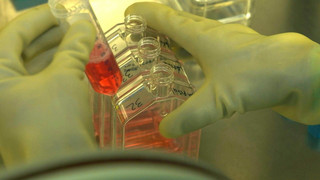 Neue Haut für die Brandopfer von Crans-Montana