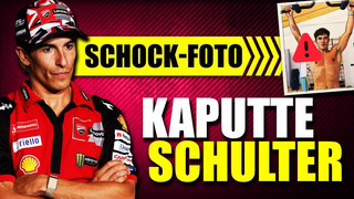 Marc Marquez zeigt kaputte Schulter: Warum gerade jetzt?