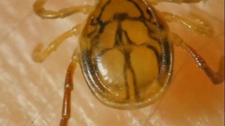 6 Tipps: So schützt man sich vor Zecken, Borreliose und FSME